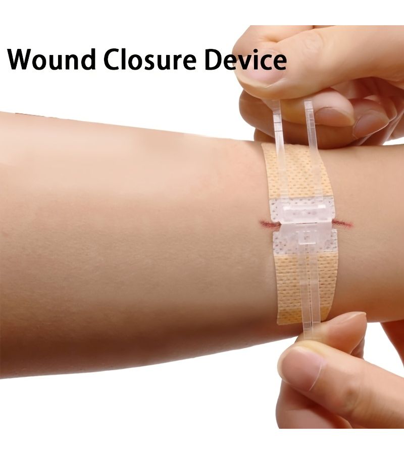 ضمادات صغيرة على شكل فراشة محسنة، 76 قطعة، طرازان، لاصقات جلدية سريعة، يمكن التخلص منها، مصنوعة من مادة البولي إيثيلين غير المنسوجة، مجموعة بحجم 4.5 و3.15 بوصة، مناسبة لأي منطقة في الجسم. - Image 3