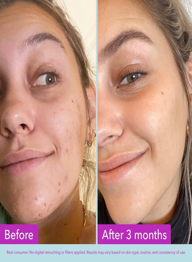 Good Molecules Niacinamide Brightening Toner - Toner for Face with Niacinamide and Arbutin for Skin Tone Balancing- Pore Minimizer, Skin Care for Face - Image 3