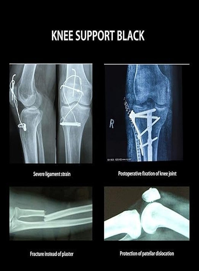 KUDIZE Knee Immobilizer Brace for Knee support for dislocation injuries ligament tear wraparound knee stabilizer splint for men & women (MEDIUM) - Image 4