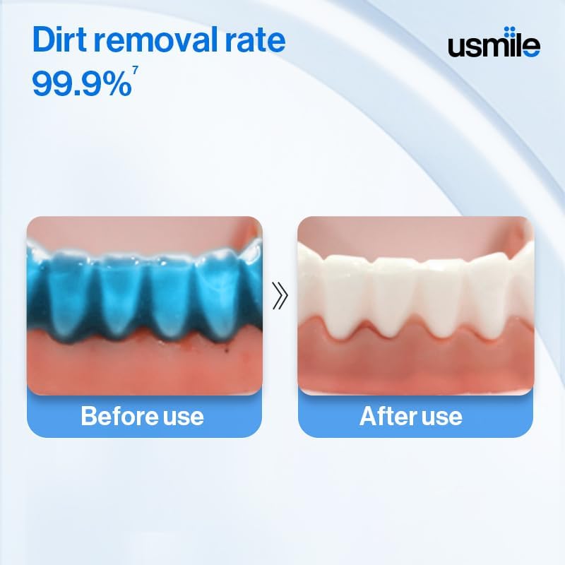usmile All budget friendly options Water Flosser Ultrasonic Water Flosser, Your Ideal Choice for Your Oral Health and Daily Hygiene, Modern and Stylish Design, Combining Convenience and Efficiency in Removing Pulp Consistent single item quality - Image 3