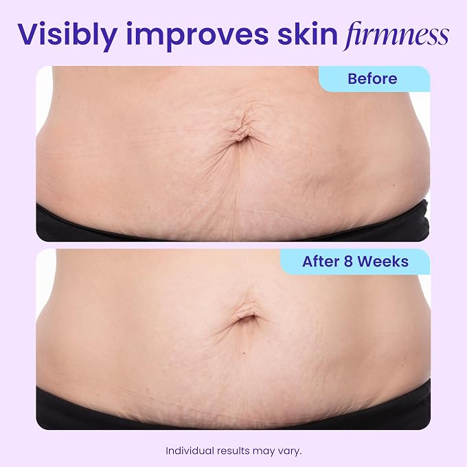 goPure Firming Belly Cream - Dermatologist-Developed Moisturizer with MicroTight4 Complex - Green Microalgae, Longan Seed, Copper Tripeptide-1 - Quick Absorbing for Smooth, Firmer-looking Skin - Image 3