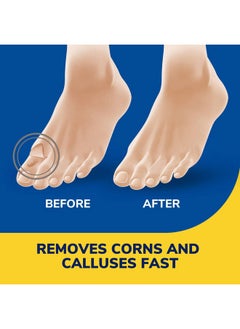 Dr. Scholl's Liquid Corn & Callus Remover, 0.33 Ounce // Removes Corns & Calluses Fast with Cushions That Provide Protection Against Shoe Pressure and Friction for All-Day Pain Relief  - Image 3