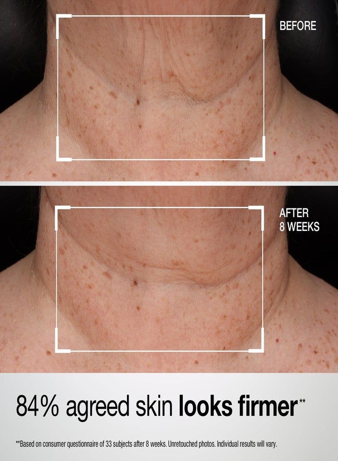 StriVectin TL Advanced Tightening Neck & Chest Lotion Broad Spectrum SPF 35 Sunscreen - Image 3