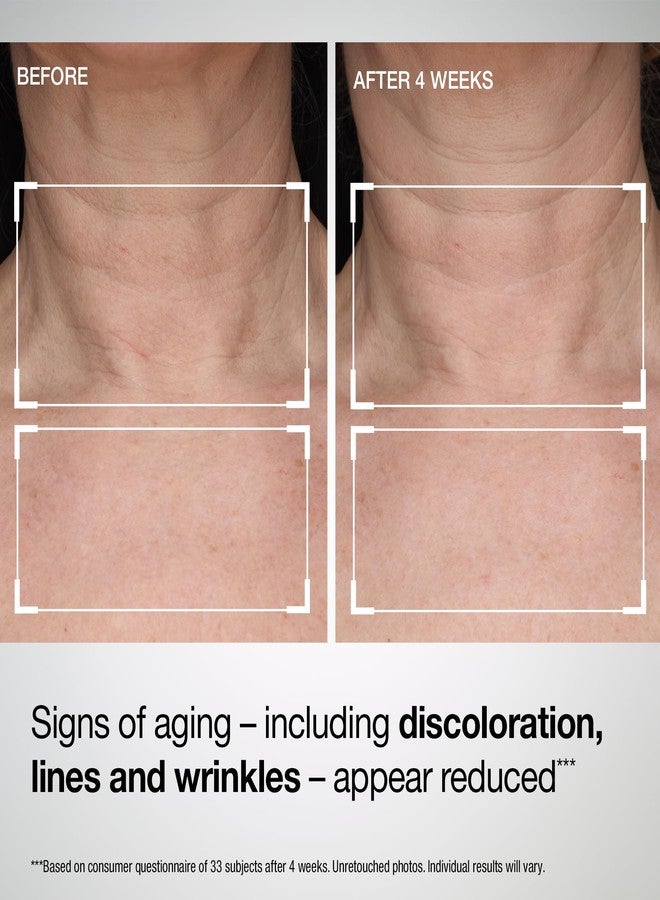 StriVectin TL Advanced Tightening Neck & Chest Lotion Broad Spectrum SPF 35 Sunscreen - Image 4