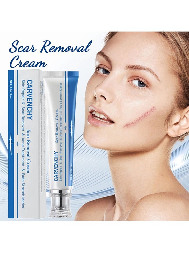 CARVENCHY Scar Removal Cream - Acne Scar Cream Rapid Repair Scar Cream for Acne Surgery Injury Burns Advanced Gel Acne Scar Spot Treatment Suitable for All Skin Types 30g - Image 1