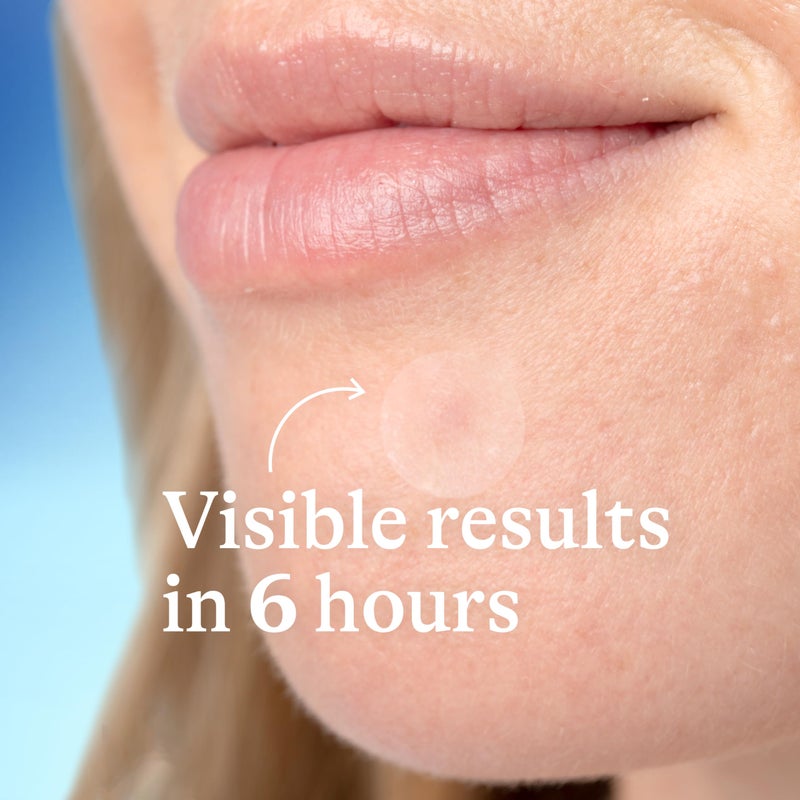 Differin Acne Patches, Pimple Patches for Acne Prone Skin, Formulated with Salicylic Acid and Centella, Fast Triple Action Power Patch for Day & Night, Dermatologist Tested, 36 Count - Image 4