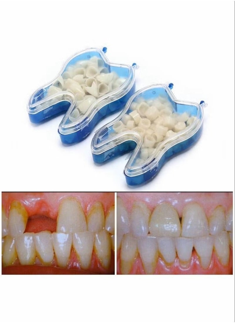 Generic - 50 Pcs Temporary Tooth Crown Fake Teeth Repair Material Front and Molar Posterior offering Help in Fixing Missing Broken Tooth Front Teeth - Image 1