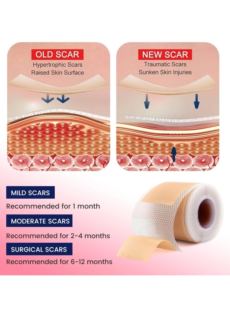 Sumifun شرائح ندبات السيليكون من السيليكون الطبي - 1.5م، شريط ندبات السيليكون للكيلويد، ندبات العملية القيصرية، إزالة ندبات الجراحة، لفة جل السيليكون، لاصقات إزالة الندبات، شرائط إزالة الندبات - Image 2