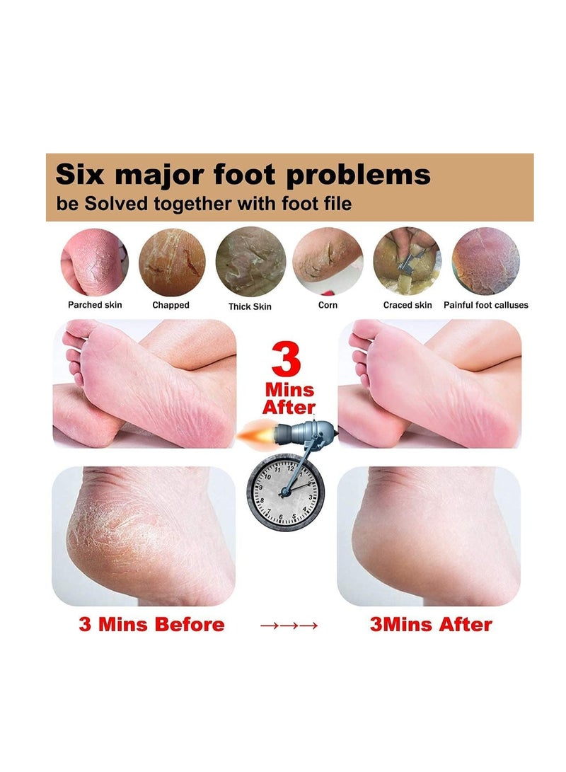 Double Sided Wooden Pedicure Feet Scrubber With Handle For Callus, Dry,Pumice Stone And Dead Skin Removal. - Image 4