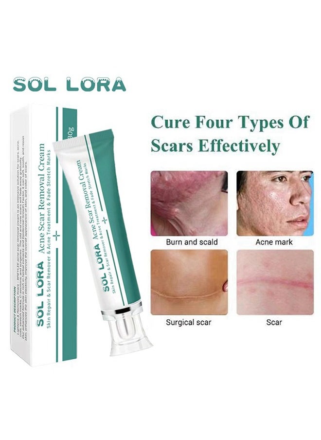 SOL LORA Acne Scar Removal Cream，Skin Repair Scar Remover & Acne Treatment & Fade Stretch Marks, Scar Erase ,Scar Removal Gel，Acne Scar Treatment，Deep Acne Scar Removal,Burns Keloids Hypertrophic, Repair Damaged Skin 30g 