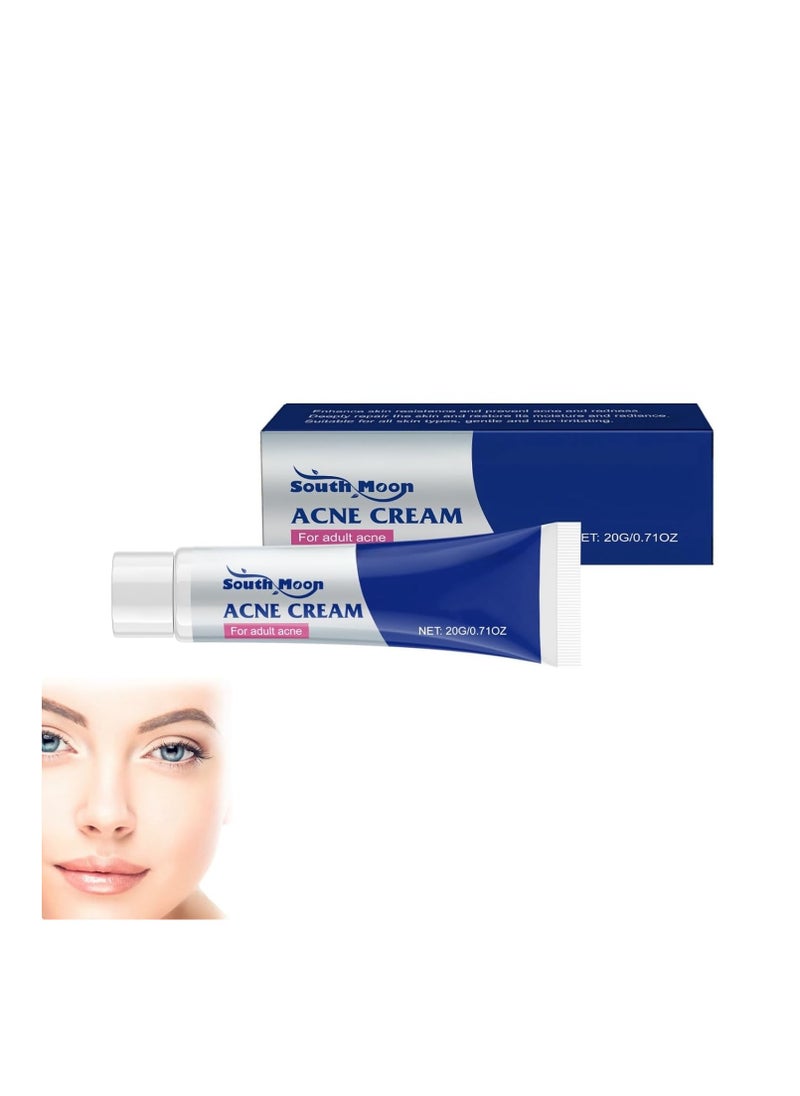 SOUTH MOON - Acne Cream Pimple Cream for Face,Buttocks, Thigh & Chest Acne Removal,Hydrating Lactic Acid for Acne-Prone Skin (0.71OZ) - Image 1