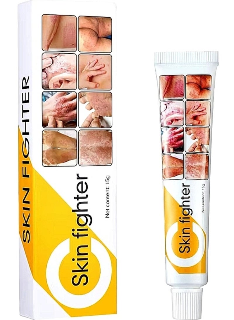 MD Skin Fighter Cream for Skin Allergies or Fungus15gm