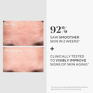 Murad سيروم تجديد الشباب من مراد ريتينول لمكافحة الشيخوخة لخطوط التجاعيد 30 مل - Image 3