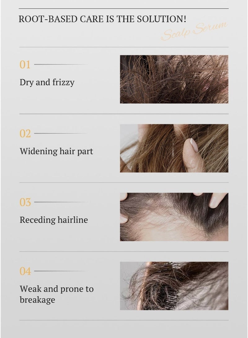 Kormesic 5% Minoxidil Hair Growth Serum For Men and Women, Biotin Hair Serum, Hair Growth, Prevent Scalp Hair Loss - Image 4