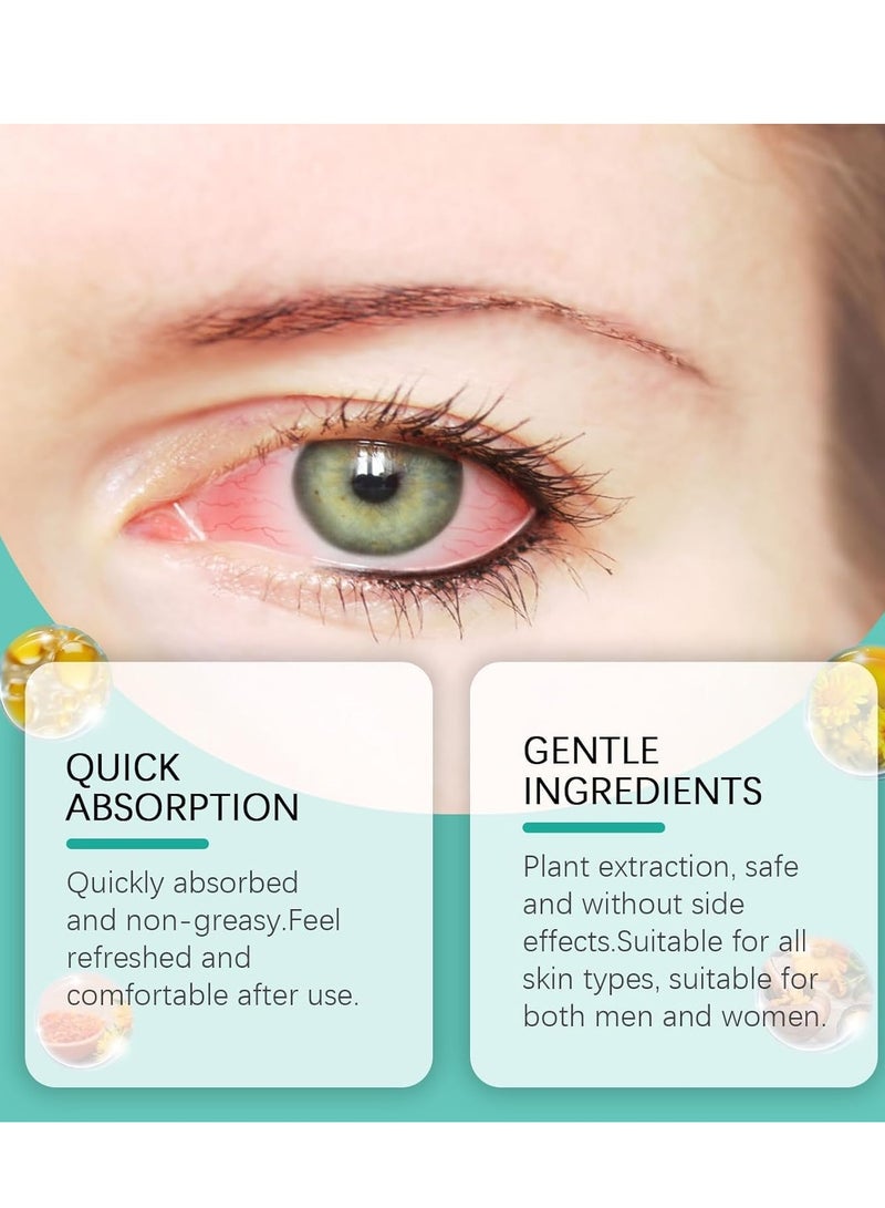 ximonth 2Pcs Vision Enhance Roller Eye Massage Roller, Relieves Eye Strain, Boosts Visual Clarity, Perfect for Eye Relaxation, Suitable for Gamers and Night Owls - Image 2