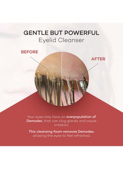 Zocular Zocular ZocuFoam Eyelid Cleanser - Foaming Eyelid Scrub - Natural pH Balanced Solution - 1.7 FL OZ (50mL)  - Image 4