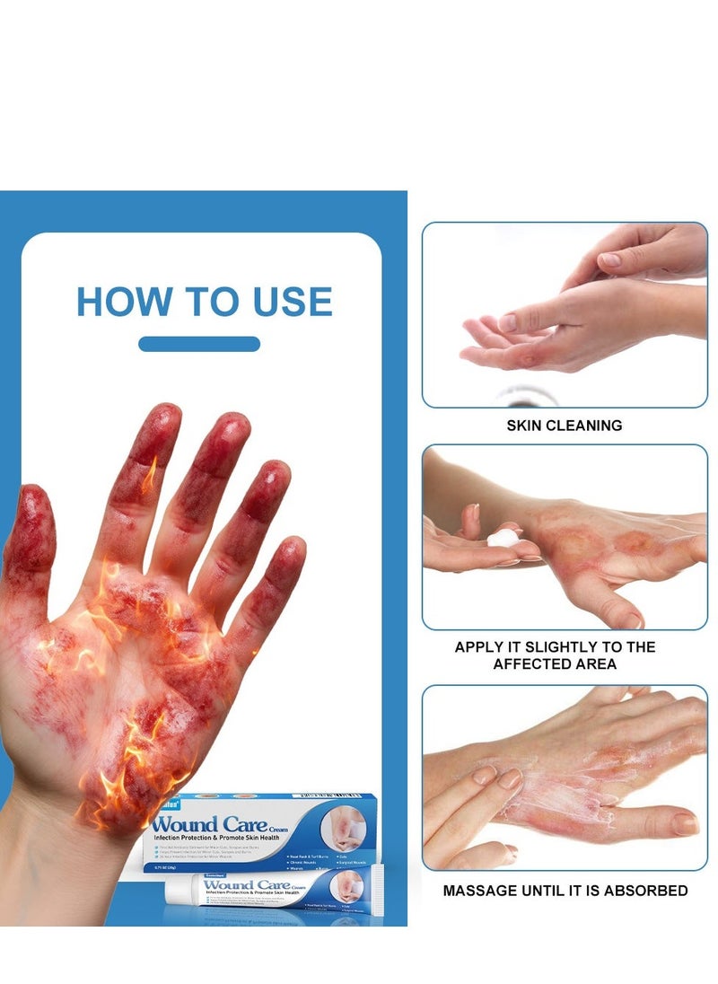 Sumifun Wound Care Cream 20g, Burn Relief Ointment for Soothing & Cooling, Ideal for Treating Burns & Scalds, Prevents Infection, Protects Skin Health, Lowers Skin Temperature to Halt Burn Progression - Image 5