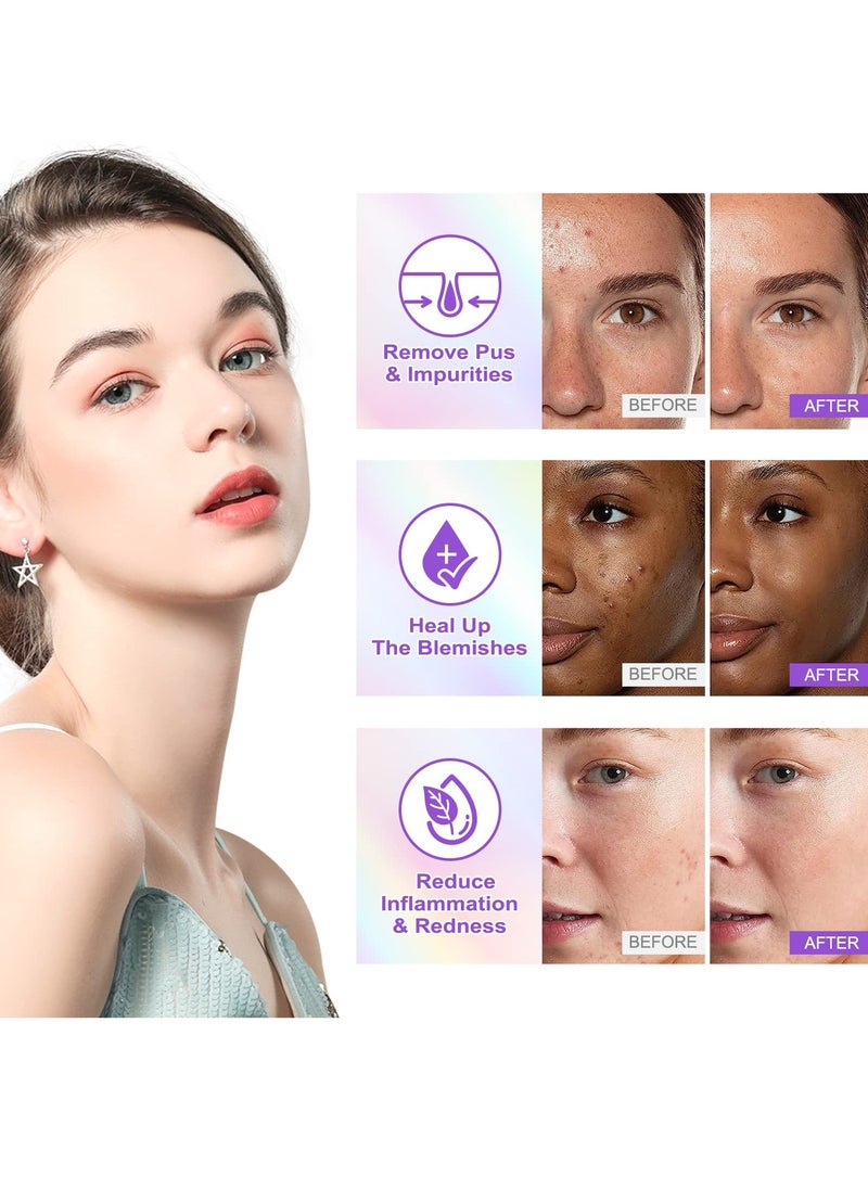 SYOSI - Acne Pimple Patch Invisible Hydrocolloid Acne Patch with Natural Green Algae Extract Tea Tree Oil for Face Acne Reduce Acne Spot Healing Patch Zit Patches for Face - Image 1