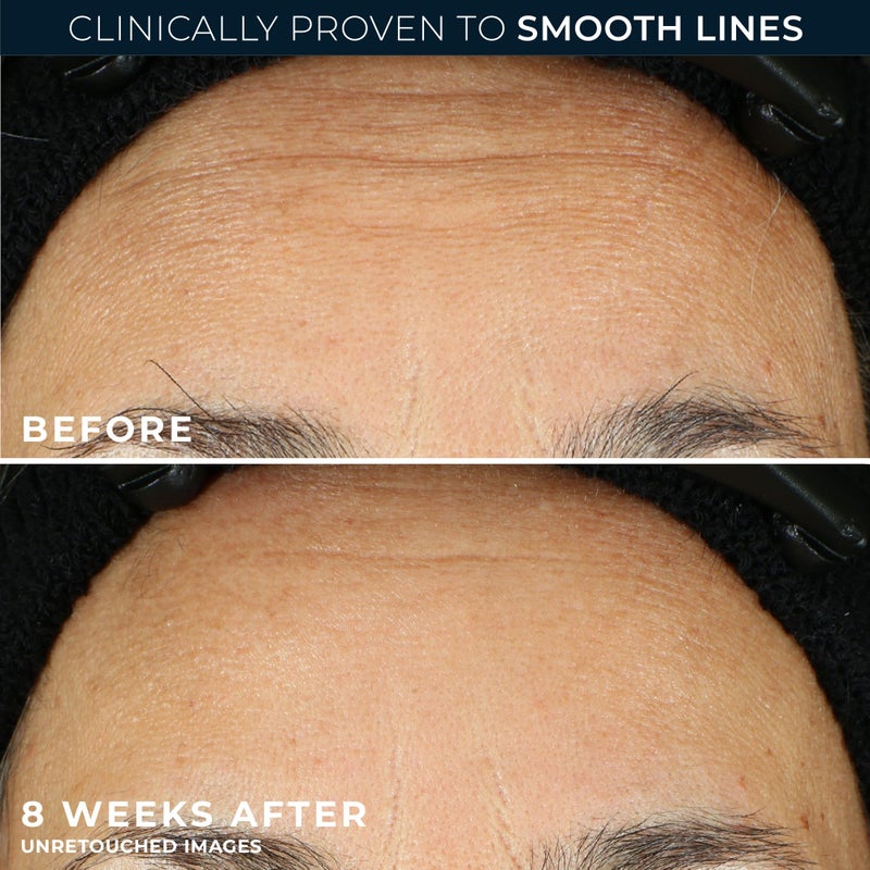 RoC Retinol Correxion Line Smoothing Night Serum Capsules, Daily Anti-Aging Skin Care Treatment for Fine Lines, Dark Spots, Acne Scars, 10 Count - Image 4