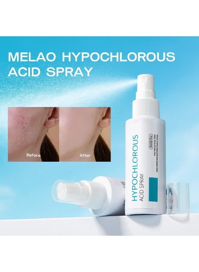 MELAO Hypochlorous Acid Facial Spray 60ml - Soothing Anti-Acne Face Mist, Pore Purifying & Redness Relief for Acne, Dry Scalp, and Eyelash Cleansing - Image 3