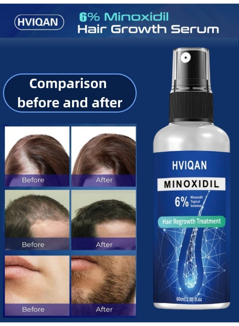 Hviqan Hviqan 6% Minoxidil Hair Growth Spray for Men & Women - 60ml Scalp Treatment to Stop Hair Loss, Thicken Hair & Boost Regrowth | Clinically Proven Formula - Image 3
