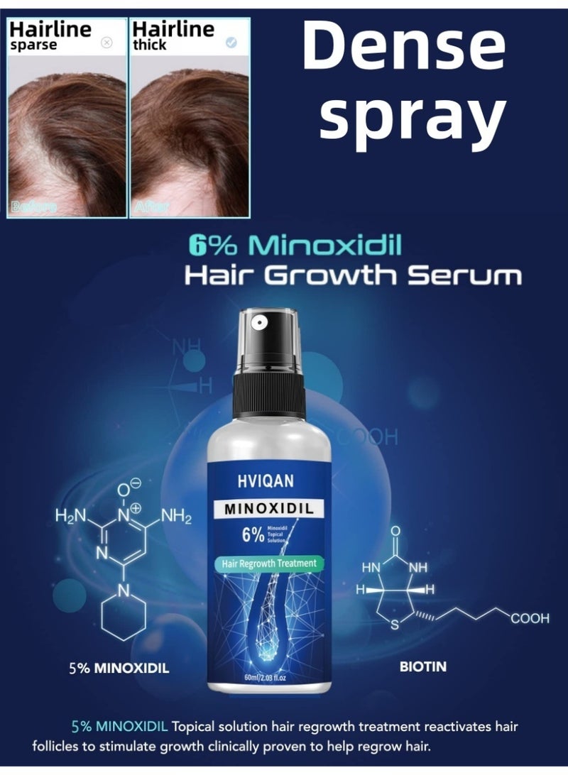 Hviqan Hviqan 6% Minoxidil Hair Growth Spray for Men & Women - 60ml Scalp Treatment to Stop Hair Loss, Thicken Hair & Boost Regrowth | Clinically Proven Formula - Image 1