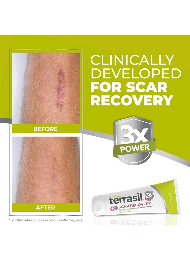 تيراسيل كريم تيراسيل لعلاج الندبات، علاج الندبات القديمة والجديدة، علامات التمدد، الغرز، حب الشباب، الحروق، الجدرة، الجراحة، يقلل من ظهور الندبات، مكونات طبيعية بالكامل ومختبرة من قبل أطباء الجلدية (1 أونصة) - Image 2