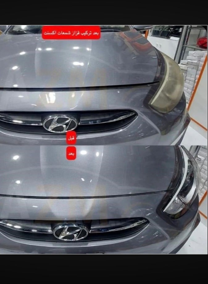 واي ام قزاز شمعات هيونداي اكسنت 2011 - 2014 قطعتين - Image 3