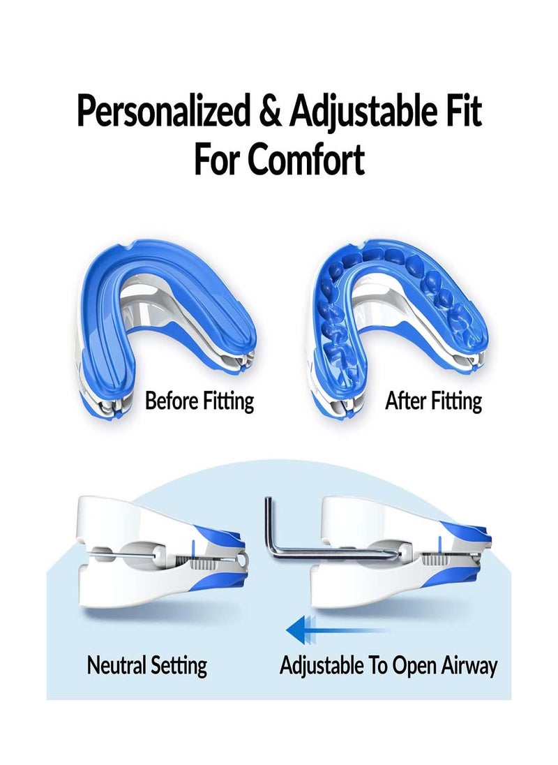 SYOSI - Anti-snoring Device Mouthpiece, Upgraded Adjustable Mouth Type Silicone Anti-snoring Device, Help Sleep at Night, Prevent Snoring and Snoring, Anti-grinding Braces Snoring Device (Standard Size) - Image 1