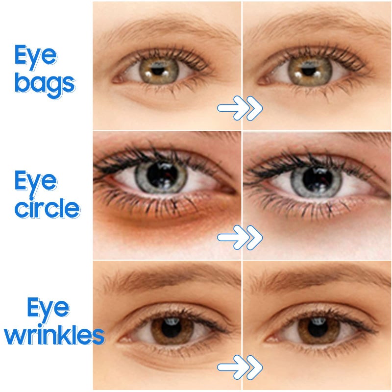 Ruzzut Under Eye Patches - 30 Pairs Collagen Eye Mask Eye Patches for Puffy Eyes and Dark Circles, Gel Under Eye Mask, Black - Image 3