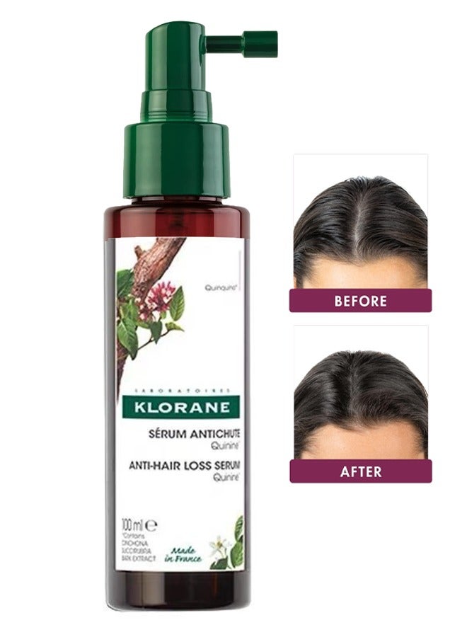 كلوران مصل مكافحة تساقط الشعر 100 مل ، لترقيق الشعر ، رذاذ مكافحة الكسر وتقوية الشعر ، جوهر العناية بفروة الرأس لتساقط الشعر للرجال والنساء - Image 1