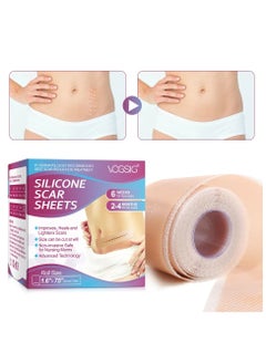 VOGSIG Medical Grade Silicone Scar Sheets Roll 1.9m Tape Keloid C-Section Surgical Scars Removal Treatment Silicon Gel Cream Patch Bandage Removes Abs Tuck Surgery Scars (4cm x 1.9m)  - Image 2