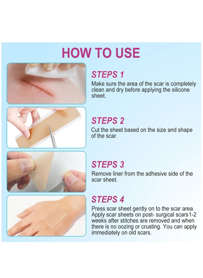 VOGSIG Medical Grade Silicone Scar Sheets Roll 1.9m Tape Keloid C-Section Surgical Scars Removal Treatment Silicon Gel Cream Patch Bandage Removes Abs Tuck Surgery Scars (4cm x 1.9m)  - Image 4