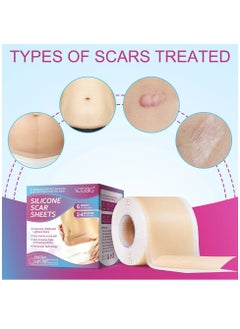 VOGSIG Medical Grade Silicone Scar Sheets Roll 1.9m Tape Keloid C-Section Surgical Scars Removal Treatment Silicon Gel Cream Patch Bandage Removes Abs Tuck Surgery Scars (4cm x 1.9m)  - Image 3