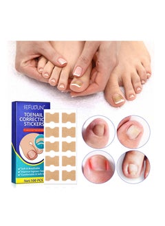 Sefudun 100 Pieces Ingrown Toenail Correction Stickers Elastic Toenail Corrector Patch Ingrown Toenail Corrector Strips Toe Nail Correction File Patches for Aesthetic Feet Relieves Pain Unisex  - Image 2