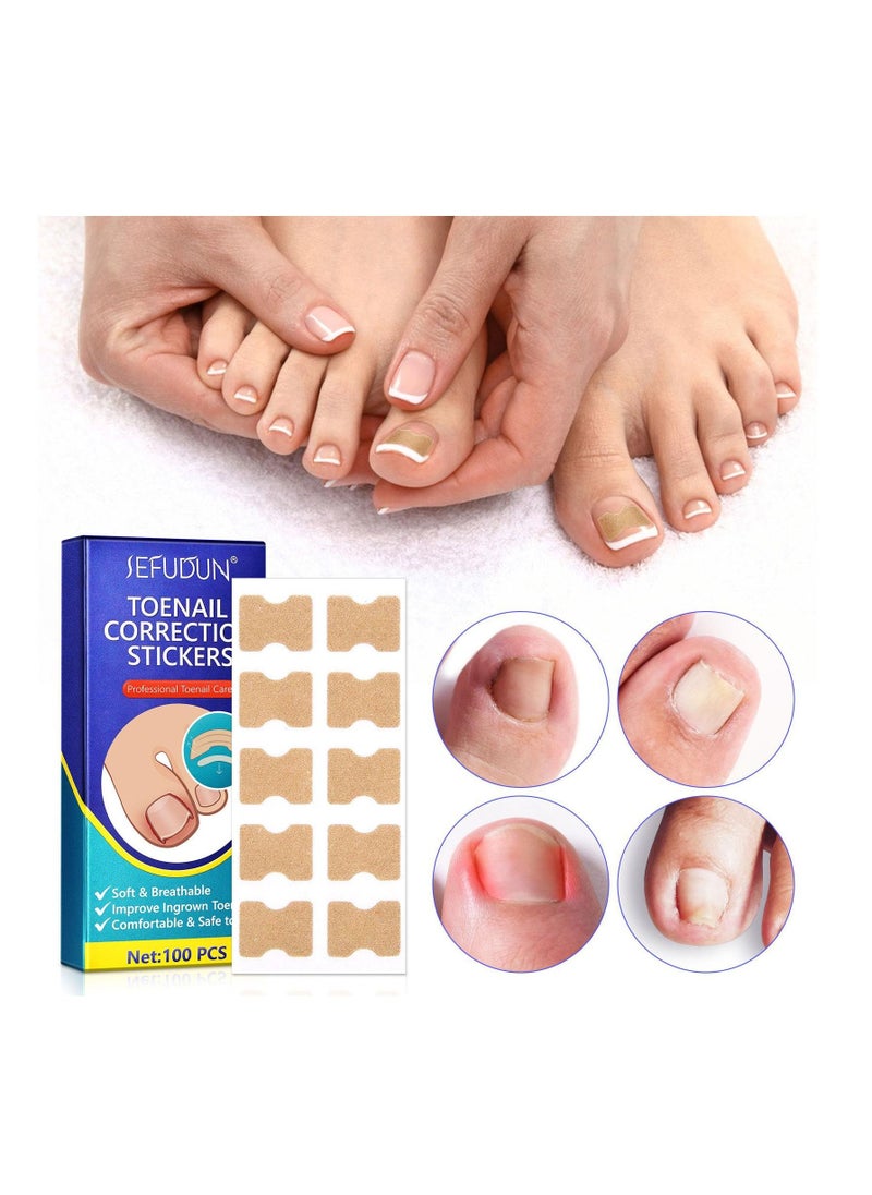 Sefudun 100 Pieces Ingrown Toenail Correction Stickers Elastic Toenail Corrector Patch Ingrown Toenail Corrector Strips Toe Nail Correction File Patches for Aesthetic Feet Relieves Pain Unisex  - Image 2