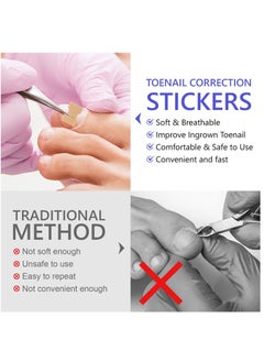 Sefudun 100 Pieces Ingrown Toenail Correction Stickers Elastic Toenail Corrector Patch Ingrown Toenail Corrector Strips Toe Nail Correction File Patches for Aesthetic Feet Relieves Pain Unisex  - Image 3