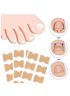 Sefudun 100 Pieces Ingrown Toenail Correction Stickers Elastic Toenail Corrector Patch Ingrown Toenail Corrector Strips Toe Nail Correction File Patches for Aesthetic Feet Relieves Pain Unisex  - Image 4