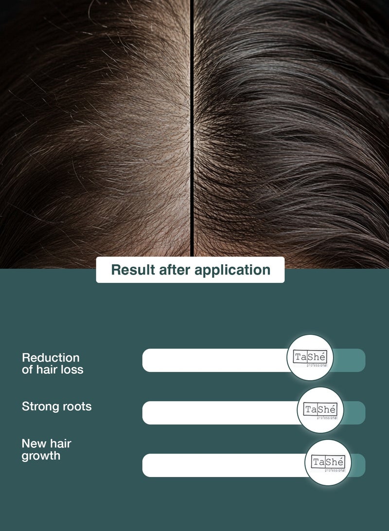 Tashe Rosemary Hair & Scalp Oil with Stimulating Botanical Blend, 100 ml  - Image 2