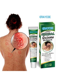 ERAYCEE Treatment Psoriasis Eczema Cream Antibacterial Antipruritic Dermatitis Herbal Ointment Anti-itch Medical Plaster  - Image 1