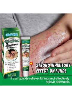 ERAYCEE Treatment Psoriasis Eczema Cream Antibacterial Antipruritic Dermatitis Herbal Ointment Anti-itch Medical Plaster  - Image 2
