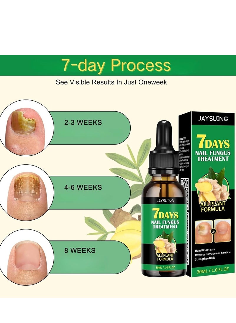 Jaysuing 7 days nail fungus treatment Ginger Nail Treatment, Nail Treatment, Nail Growth Serum, Ginger Nail Serum, Nail Nutrient Oil Strengthener Oil 2PCS - Image 5