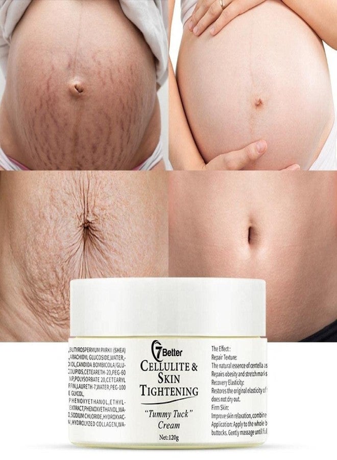 7better LLC Stretch Marks and Scars Removal Cream for Pregnancy - Scars Repair, Abdominal Firming, and Gentle Stretch Marks Eradication Skincare Body - Image 2