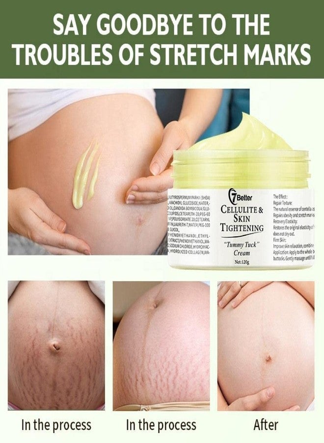 7better LLC Stretch Marks and Scars Removal Cream for Pregnancy - Scars Repair, Abdominal Firming, and Gentle Stretch Marks Eradication Skincare Body - Image 3