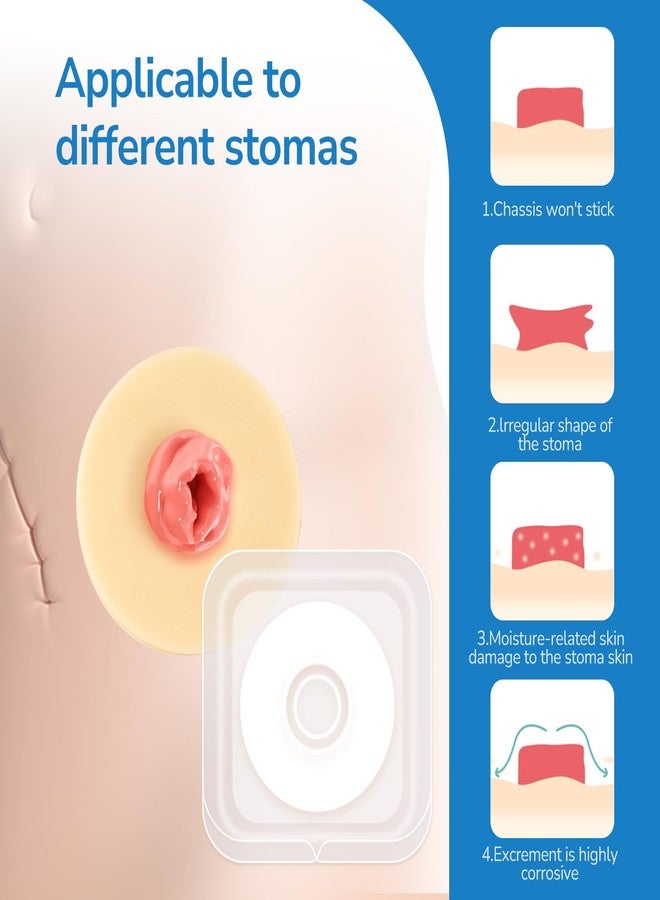 Heagimed 10PCS Ostomy Barrier Rings, Ostomy Supplies, 4mm Thickness Moldable Ostomy Rings Medical Grade Hydrocolloid Adhesive Barrier Rings Better Seal for Ostomy Bags (Box of 10 - Image 5