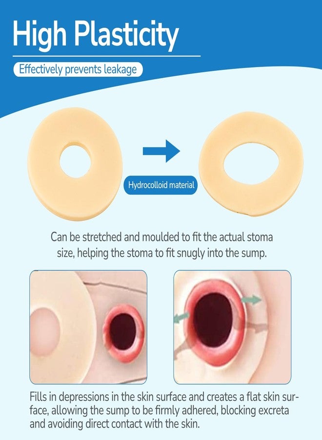 Heagimed 10PCS Ostomy Barrier Rings, Ostomy Supplies, 4mm Thickness Moldable Ostomy Rings Medical Grade Hydrocolloid Adhesive Barrier Rings Better Seal for Ostomy Bags (Box of 10 - Image 3