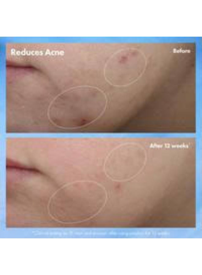 Origins Clear Improvement Acne Clearing Hydrating Lotion 50ml - Image 4
