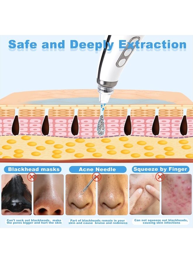EUASOO Blackhead Remover, EUASOO USB Rechargeable Pimple Extractor, Electric Pore Vacuum Blackhead Remover Tools for Women & Men, Blackhead Vacuum Kit with 10 * Filter Sponge & 5 * Rubber Ring & etc. - Image 5