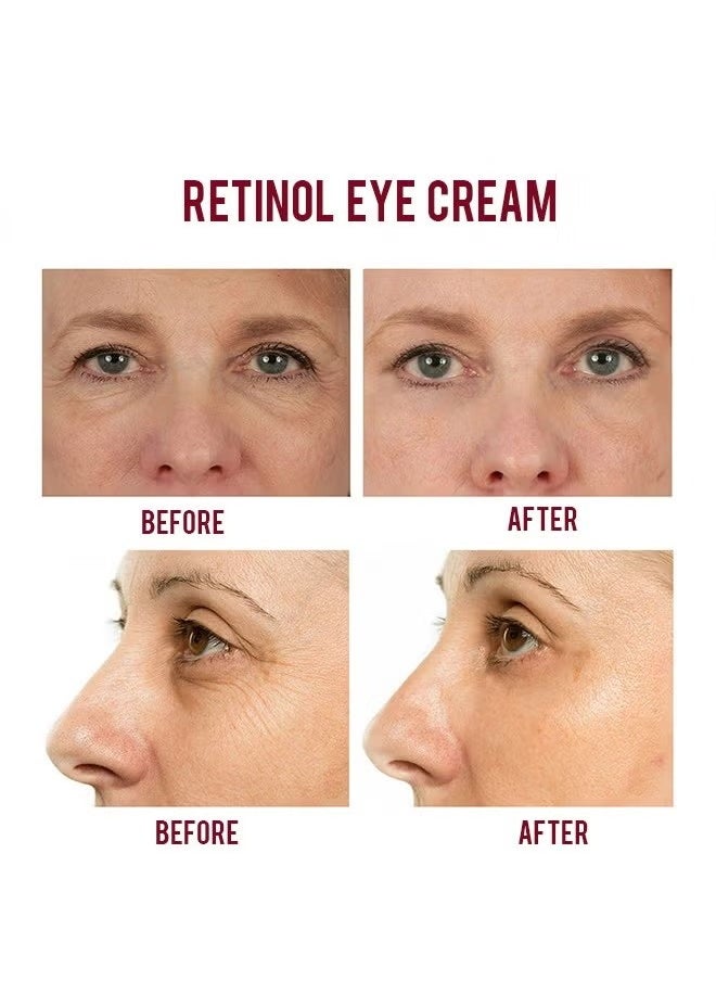 MOIKA - Retinol Repair Eye Cream-For Dark Circles and Puffiness, with AHA and BHA Dark Circle Fine Lines Treatment,Anti-aging, Under Eye Treatment,Reduces Wrinkles, Defoams and Brightens Skin 30g - Image 1