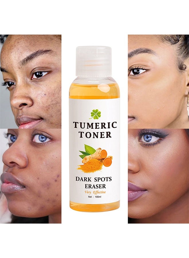 Tumeric Toner Dark Spots Eraser - Facial Toner for Acne Prone Skin, Blemish Removing Facial Moisturizer for Women, Dry Oily Skin Hyperpigmentation Treatment 100ml